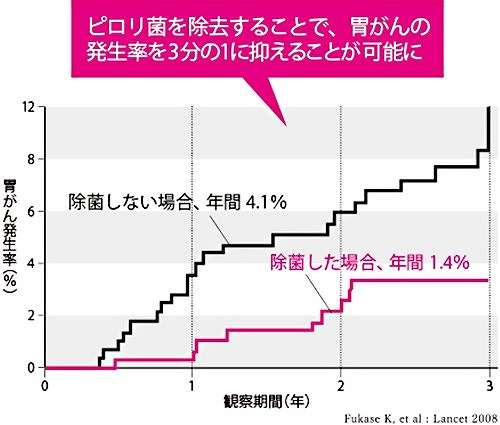 ピロリ菌除去後の胃がん発生率